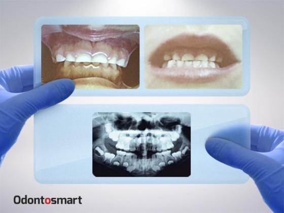 Gnatología como especialización odontológica